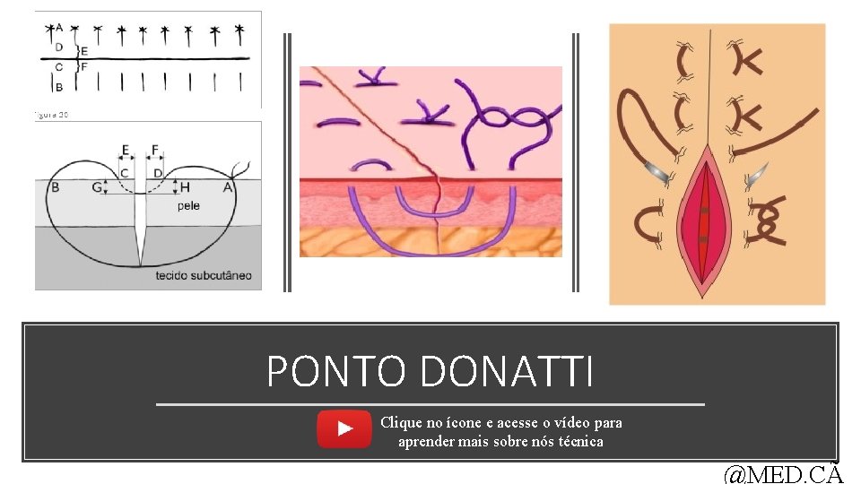 PONTO DONATTI Clique no ícone e acesse o vídeo para aprender mais sobre nós