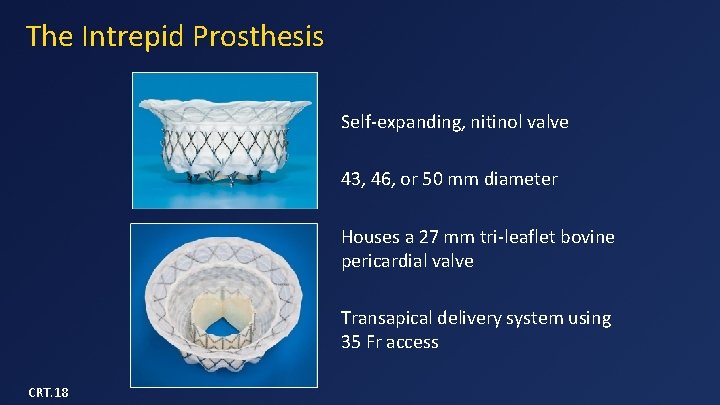 The Intrepid Prosthesis Self-expanding, nitinol valve 43, 46, or 50 mm diameter Houses a