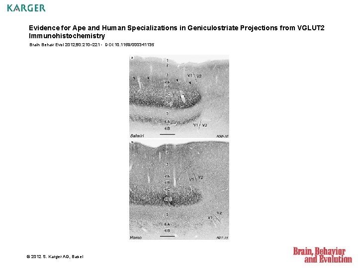 Evidence for Ape and Human Specializations in Geniculostriate Projections from VGLUT 2 Immunohistochemistry Brain