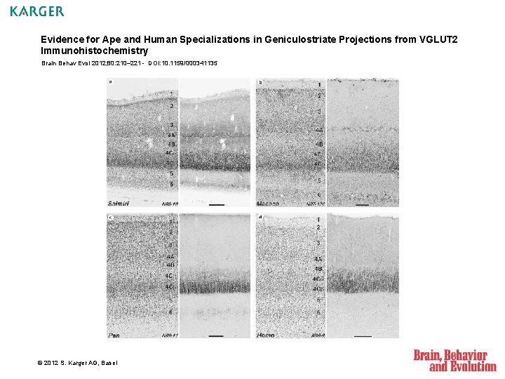 Evidence for Ape and Human Specializations in Geniculostriate Projections from VGLUT 2 Immunohistochemistry Brain