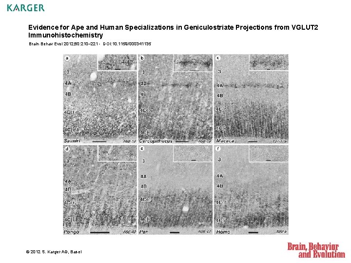 Evidence for Ape and Human Specializations in Geniculostriate Projections from VGLUT 2 Immunohistochemistry Brain