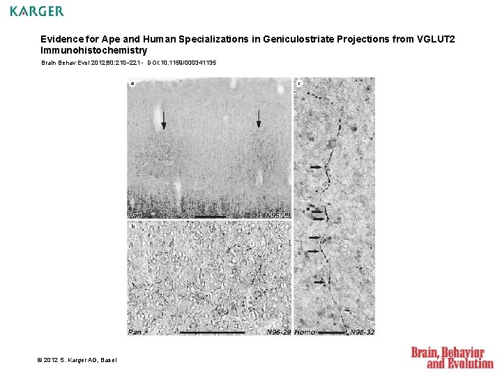 Evidence for Ape and Human Specializations in Geniculostriate Projections from VGLUT 2 Immunohistochemistry Brain