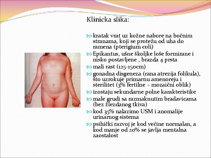 Klinicka slika: kratak vrat uz kožne nabore na bočnim stranama, koji se protežu od