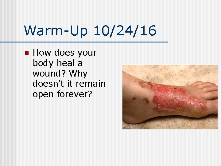 Warm-Up 10/24/16 n How does your body heal a wound? Why doesn’t it remain