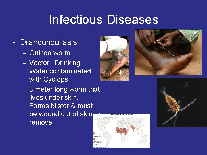 Infectious Diseases • Drancunculiasis– Guinea worm – Vector: Drinking Water contaminated with Cyclops –