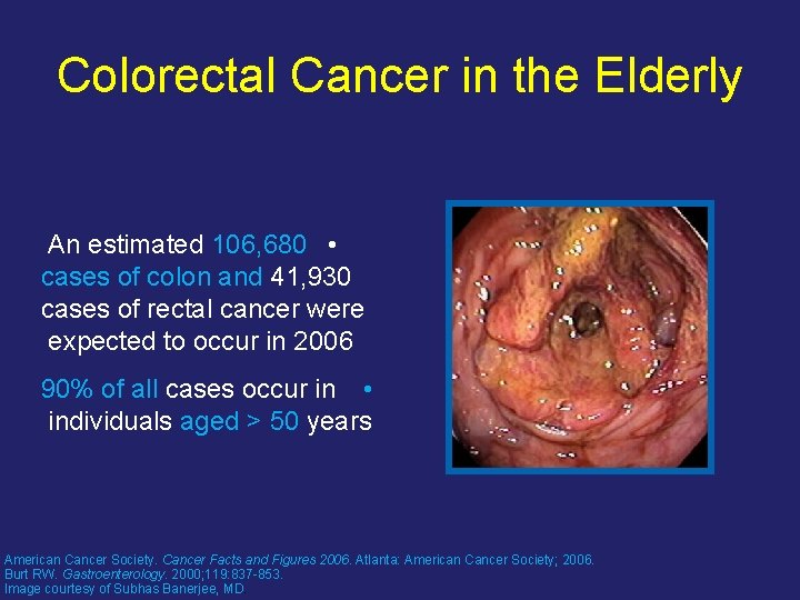 Colorectal Cancer in the Elderly An estimated 106, 680 • cases of colon and
