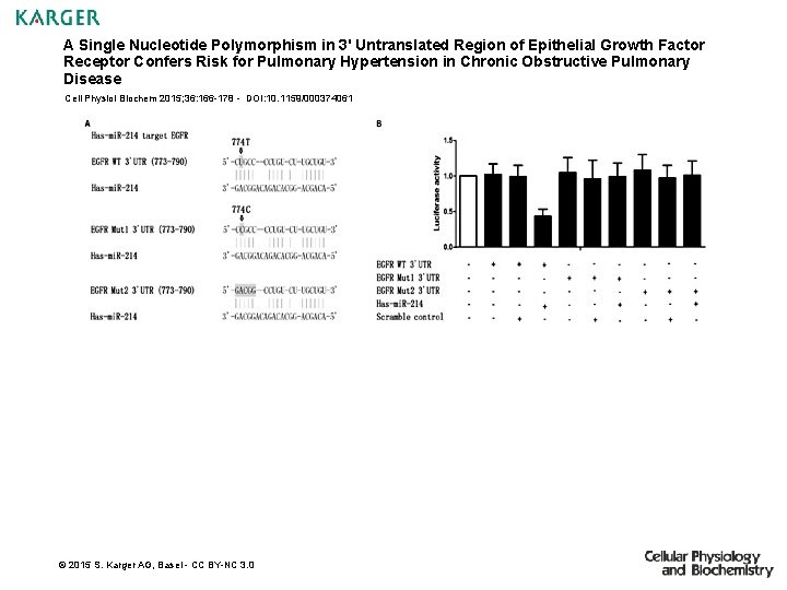 A Single Nucleotide Polymorphism in 3' Untranslated Region of Epithelial Growth Factor Receptor Confers