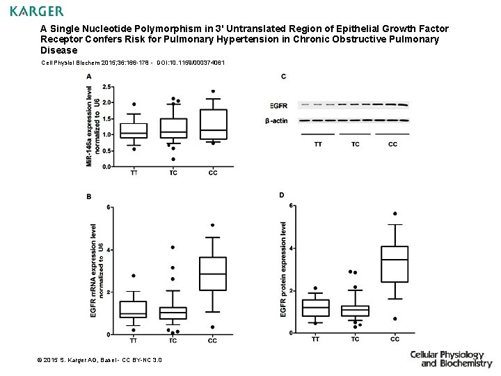 A Single Nucleotide Polymorphism in 3' Untranslated Region of Epithelial Growth Factor Receptor Confers