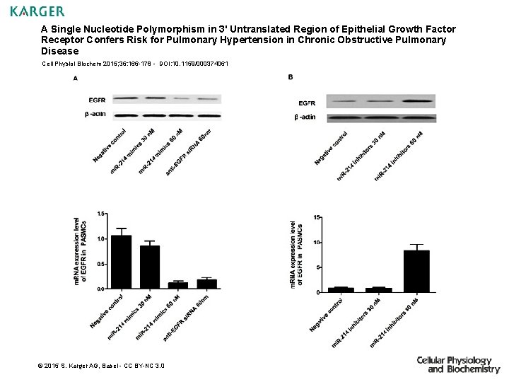 A Single Nucleotide Polymorphism in 3' Untranslated Region of Epithelial Growth Factor Receptor Confers