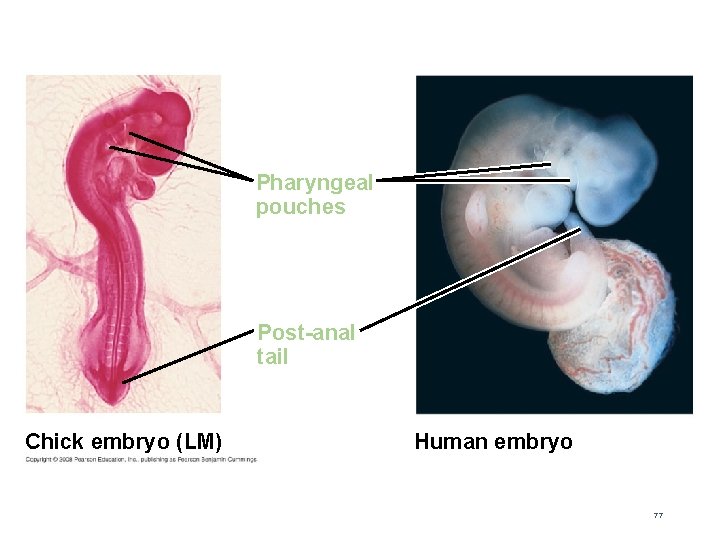 Fig. 19 -18 Pharyngeal pouches Post-anal tail Chick embryo (LM) Human embryo 77 