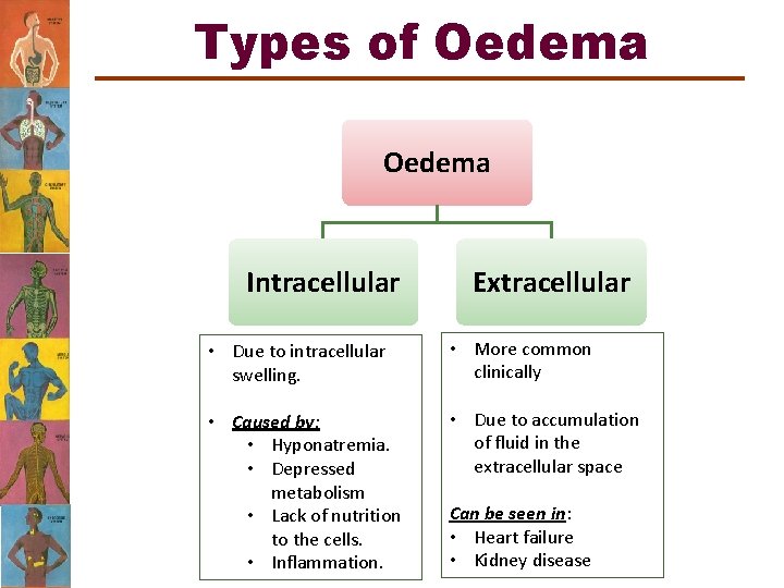 Types of Oedema Intracellular Extracellular • Due to intracellular swelling. • More common clinically