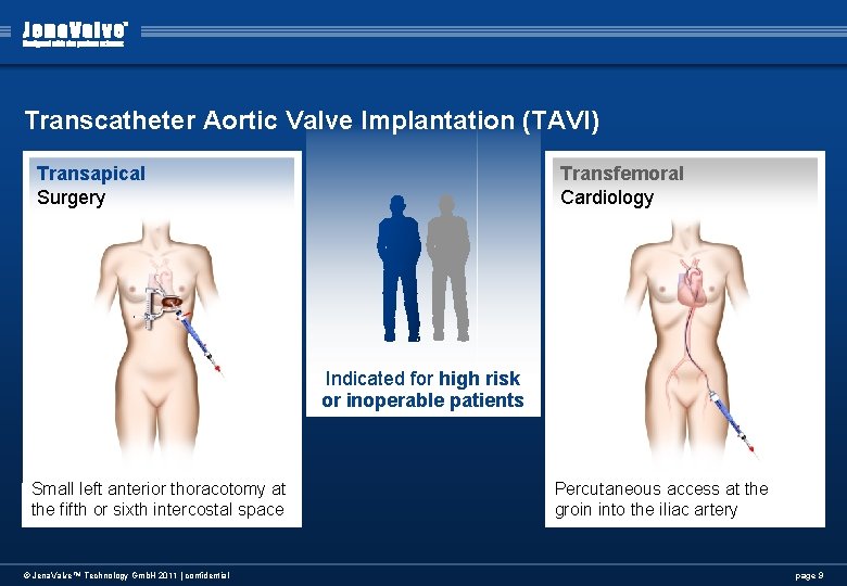 Transcatheter Aortic Valve Implantation (TAVI) Transapical Surgery Transfemoral Cardiology Indicated for high risk or Transcatheter Aortic Valve Implantation (TAVI) Transapical Surgery Transfemoral Cardiology Indicated for high risk or