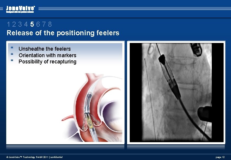12345678 Release of the positioning feelers } Unsheathe feelers } Orientation with markers } 12345678 Release of the positioning feelers } Unsheathe feelers } Orientation with markers }