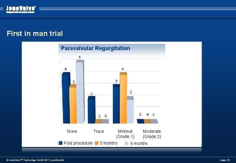 First in man trial Paravalvular Regurgitation None Post procedure © Jena. Valve™ Technology Gmb. First in man trial Paravalvular Regurgitation None Post procedure © Jena. Valve™ Technology Gmb.