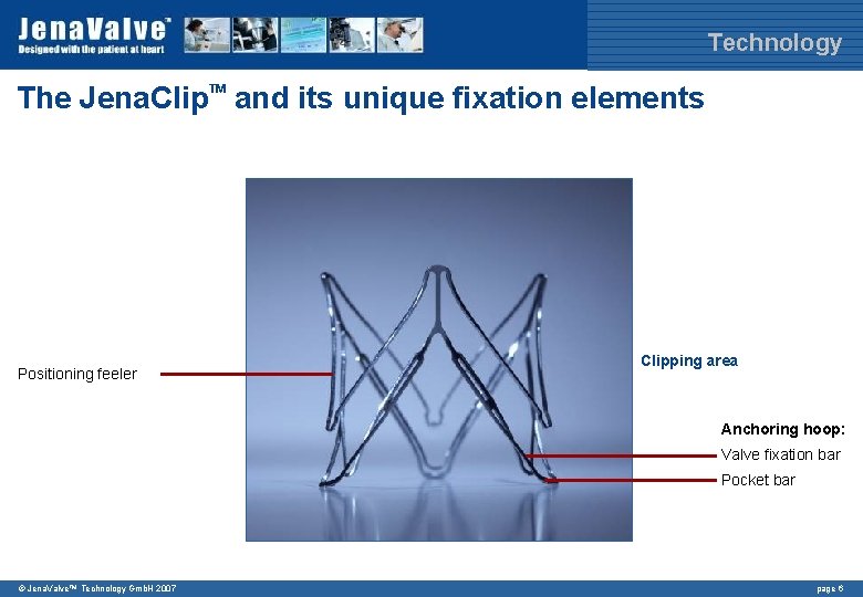Technology The Jena. Clip and its unique fixation elements TM Positioning feeler Clipping area Technology The Jena. Clip and its unique fixation elements TM Positioning feeler Clipping area