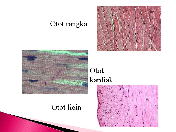 Otot rangka Otot kardiak Otot licin 