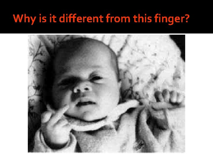 Why is it different from this finger? 