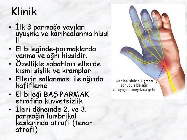 Klinik • İlk 3 parmağa yayılan uyuşma ve karıncalanma hissi !! • El bileğinde-parmaklarda