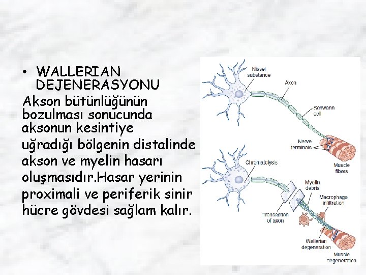  • WALLERIAN DEJENERASYONU Akson bütünlüğünün bozulması sonucunda aksonun kesintiye uğradığı bölgenin distalinde akson