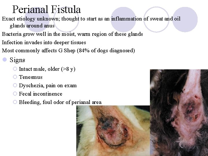 Perianal Fistula Exact etiology unknown; thought to start as an inflammation of sweat and