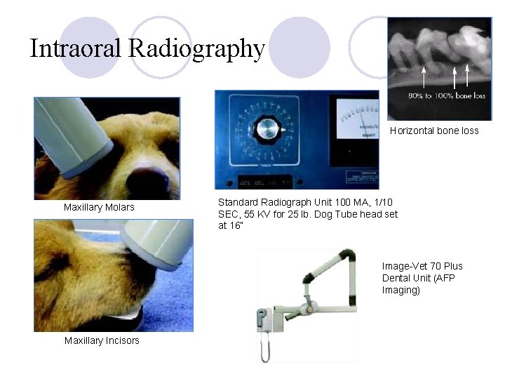 Intraoral Radiography Horizontal bone loss Maxillary Molars Standard Radiograph Unit 100 MA, 1/10 SEC,