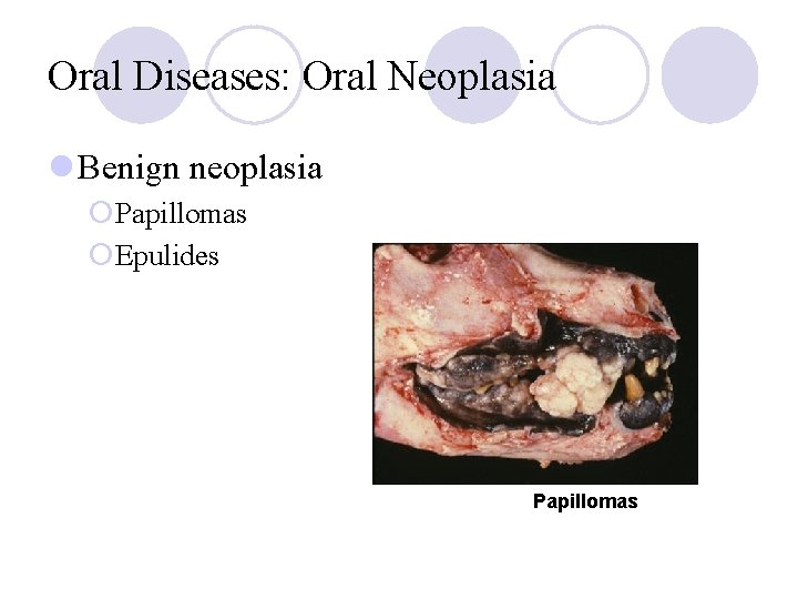 Oral Diseases: Oral Neoplasia l Benign neoplasia ¡Papillomas ¡Epulides Papillomas 