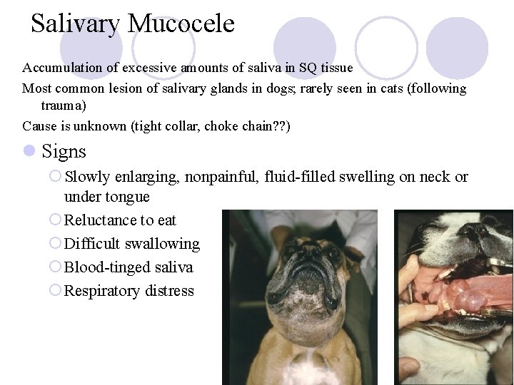 Salivary Mucocele Accumulation of excessive amounts of saliva in SQ tissue Most common lesion