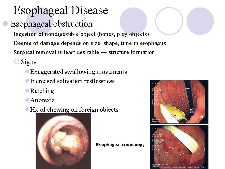 Esophageal Disease l Esophageal obstruction Ingestion of nondigestible object (bones, play objects) Degree of