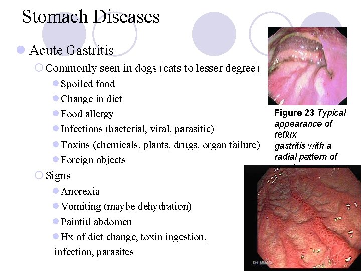 Stomach Diseases l Acute Gastritis ¡ Commonly seen in dogs (cats to lesser degree)