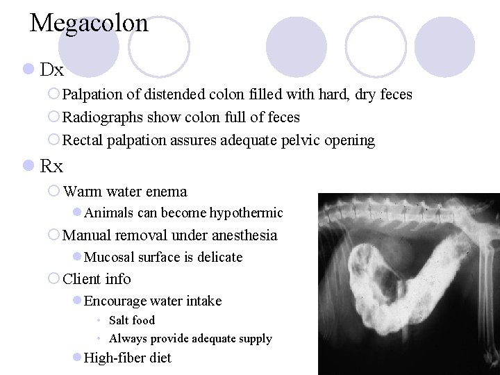 Megacolon l Dx ¡ Palpation of distended colon filled with hard, dry feces ¡