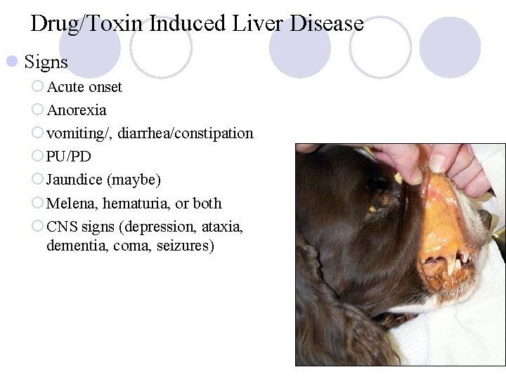 Drug/Toxin Induced Liver Disease l Signs ¡ Acute onset ¡ Anorexia ¡ vomiting/, diarrhea/constipation