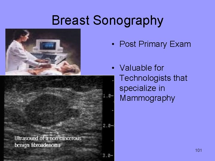 Breast Sonography • Post Primary Exam • Valuable for Technologists that specialize in Mammography