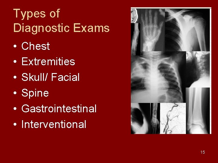 Types of Diagnostic Exams • • • Chest Extremities Skull/ Facial Spine Gastrointestinal Interventional