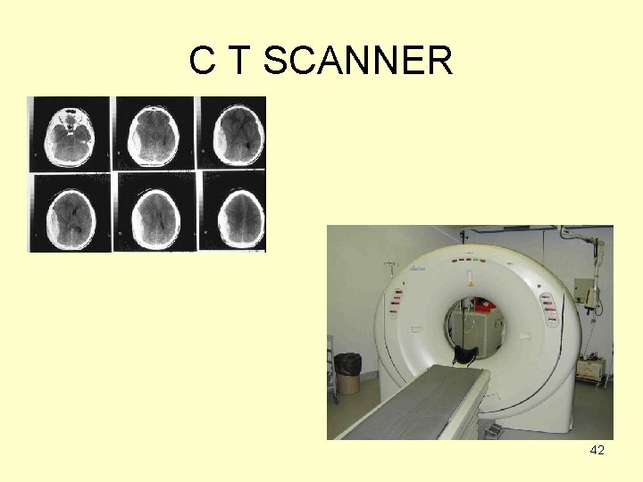 C T SCANNER 42 