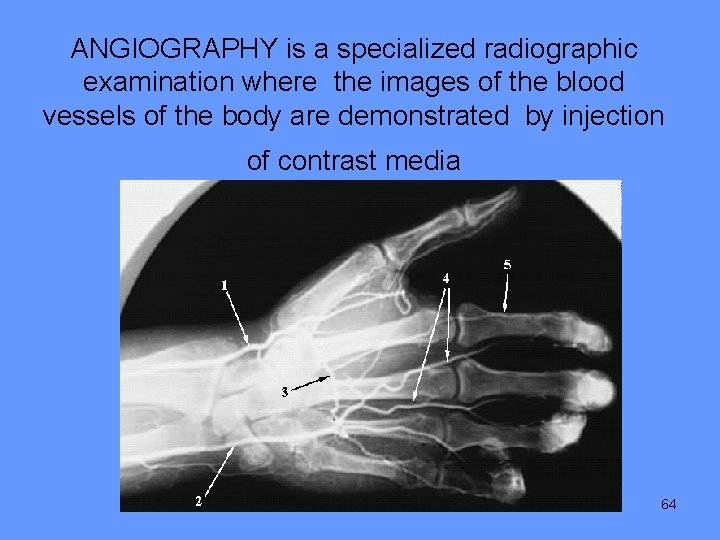 ANGIOGRAPHY is a specialized radiographic examination where the images of the blood vessels of