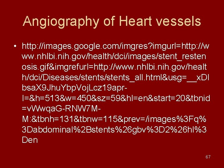 Angiography of Heart vessels • http: //images. google. com/imgres? imgurl=http: //w ww. nhlbi. nih.