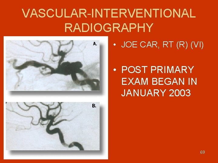 VASCULAR-INTERVENTIONAL RADIOGRAPHY • JOE CAR, RT (R) (VI) • POST PRIMARY EXAM BEGAN IN