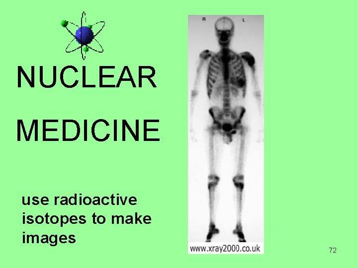 NUCLEAR MEDICINE use radioactive isotopes to make images 72 