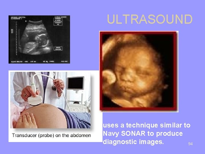 ULTRASOUND uses a technique similar to Navy SONAR to produce diagnostic images. 94 