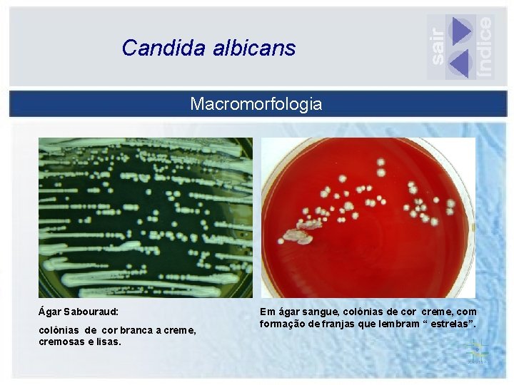 Candida albicans Macromorfologia Ágar Sabouraud: colônias de cor branca a creme, cremosas e lisas.