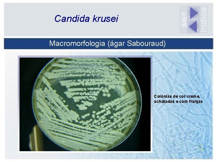 Candida krusei Macromorfologia (ágar Sabouraud) Colônias de cor creme, achatadas e com franjas 