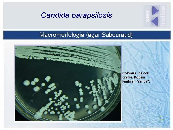 Candida parapsilosis Macromorfologia (ágar Sabouraud) Colônias de cor creme. Podem lembrar “renda”. 