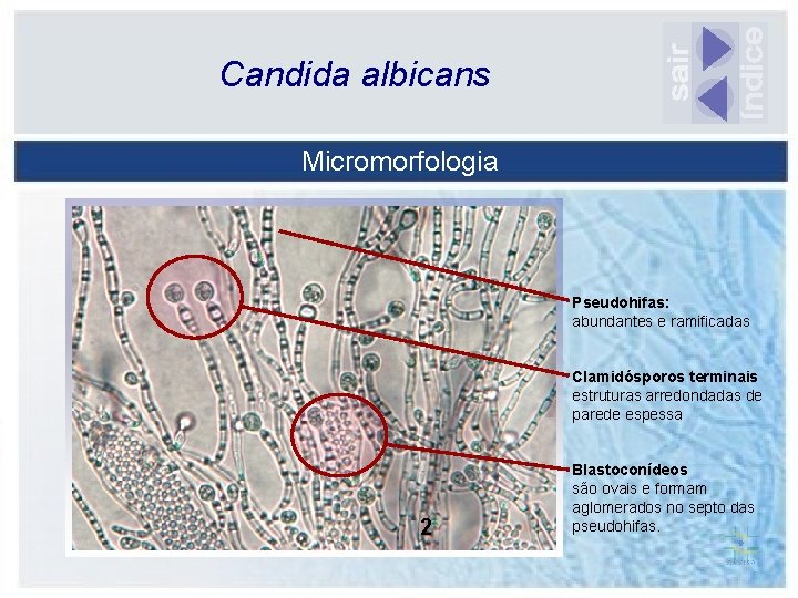 Candida albicans Micromorfologia Pseudohifas: abundantes e ramificadas Clamidósporos terminais estruturas arredondadas de parede espessa