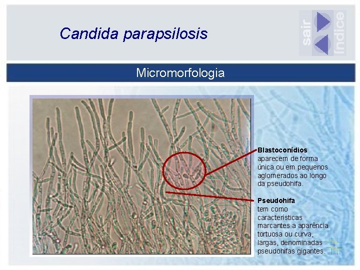 Candida parapsilosis Micromorfologia Blastoconídios aparecem de forma única ou em pequenos aglomerados ao longo