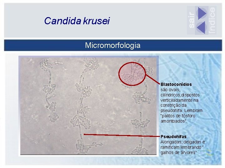 Candida krusei Micromorfologia Blastoconídios são ovais, cilíndricos, dispostos verticiladamente na constrição da pseudohifa. Lembram
