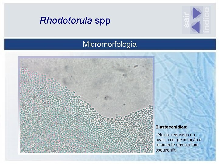 Rhodotorula spp Micromorfologia Blastoconídios: células redondas ou ovais, com gemulação e raramente apresentam pseudohifa.