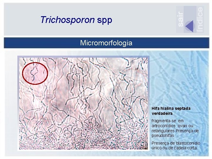 Trichosporon spp Micromorfologia Hifa hialina septada verdadeira fragmenta-se em artroconídios ovais ou retangulares. Presença