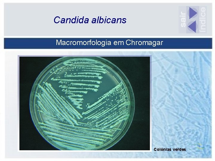 Candida albicans Macromorfologia em Chromagar Colônias verdes 