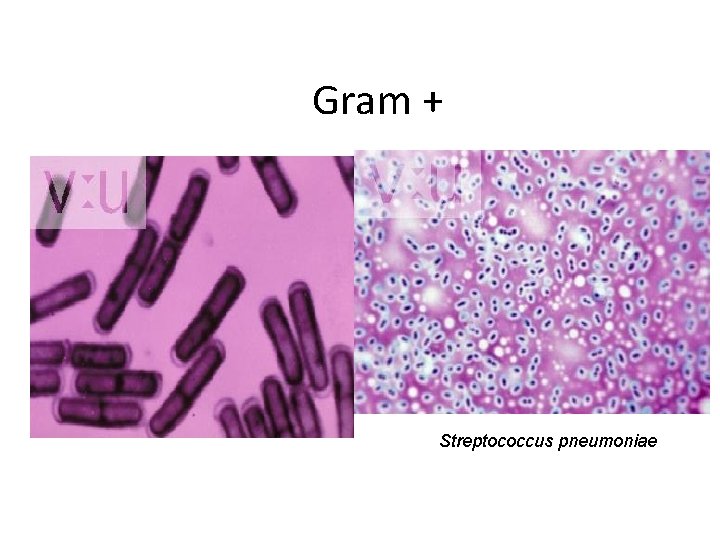 Gram + Streptococcus pneumoniae 
