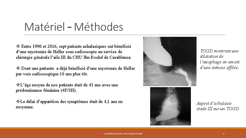 Matériel – Méthodes v Entre 1996 et 2016, sept patients achalasiques ont bénéficié d’une